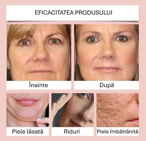before and after 3 romana